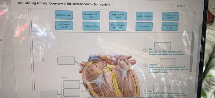 Art-labeling activity overview of the cardiac conduction system