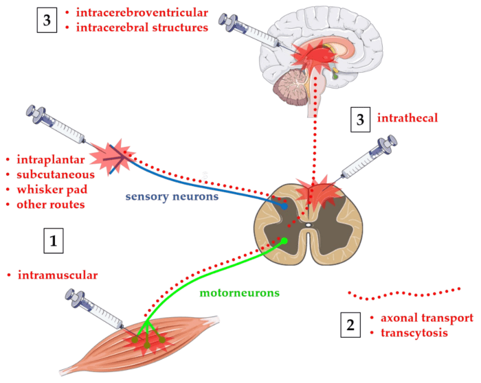 Botulinum neurotoxin blocks exocytosis of ach at the neuromuscular junction